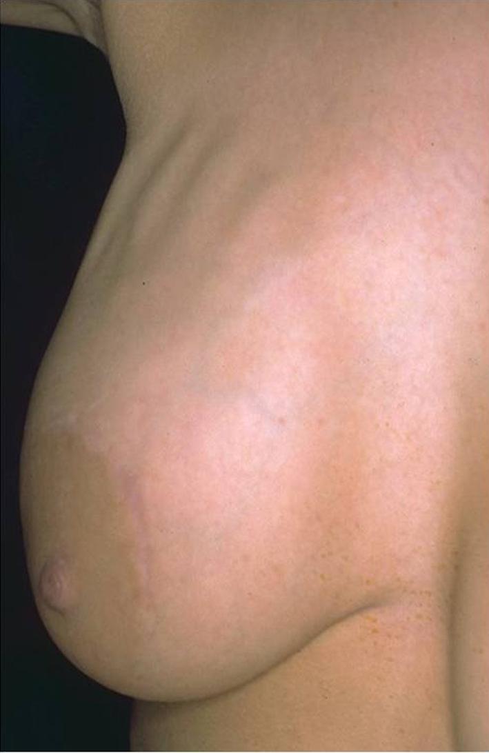 https://cdn.ncbi.nlm.nih.gov/pmc/blobs/5330/2993901/339203121e1b/266_2010_9510_Fig7_HTML.jpg