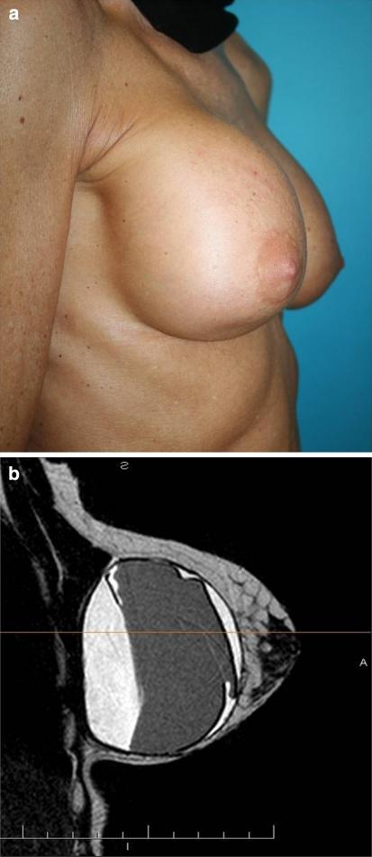 https://cdn.ncbi.nlm.nih.gov/pmc/blobs/5330/2993901/7d066e4b0f88/266_2010_9510_Fig15_HTML.jpg