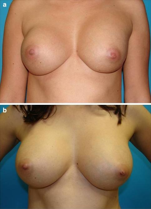 https://cdn.ncbi.nlm.nih.gov/pmc/blobs/5330/2993901/7d17df0707f3/266_2010_9510_Fig17_HTML.jpg