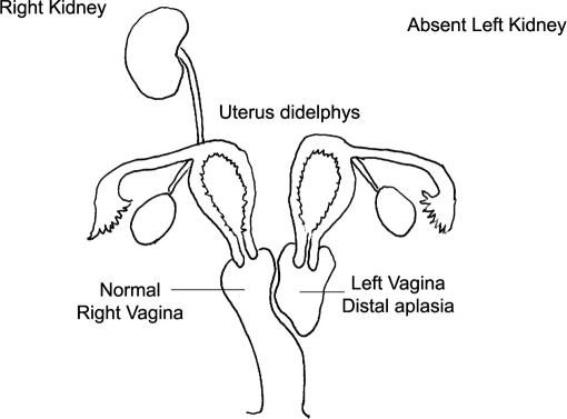 https://cdn.ncbi.nlm.nih.gov/pmc/blobs/5337/3030804/0667a248e9a8/jsls-13-4-620-g01.jpg
