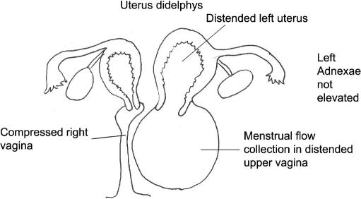 https://cdn.ncbi.nlm.nih.gov/pmc/blobs/5337/3030804/37700d161bf4/jsls-13-4-620-g02.jpg