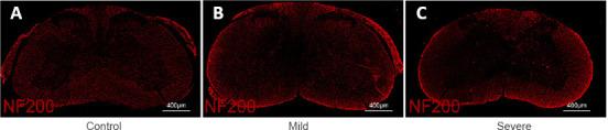 https://cdn.ncbi.nlm.nih.gov/pmc/blobs/533c/10358683/b15271290d14/NRR-18-2751-g008.jpg