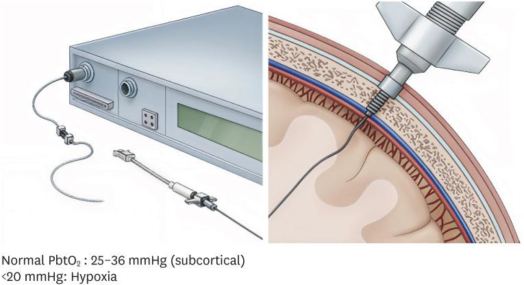 https://cdn.ncbi.nlm.nih.gov/pmc/blobs/533c/12325885/e47a0fdb4a93/kjn-21-163-g001.jpg