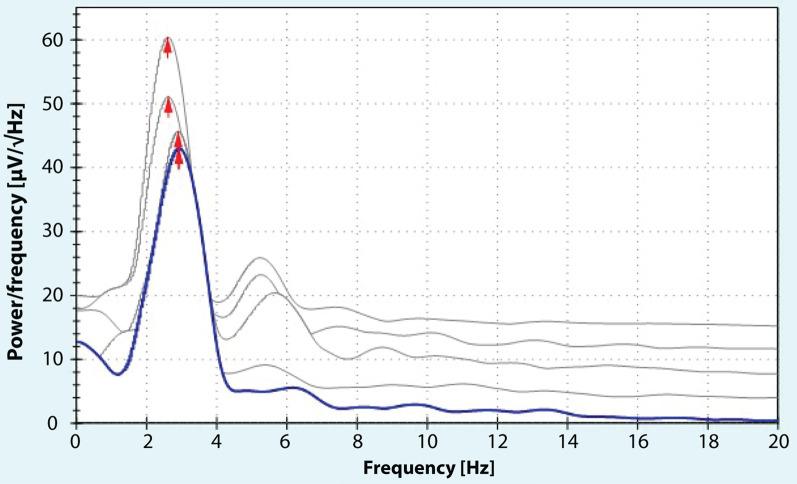 https://cdn.ncbi.nlm.nih.gov/pmc/blobs/5340/9575232/e1fa3498a45b/42466_2022_216_Fig1_HTML.jpg