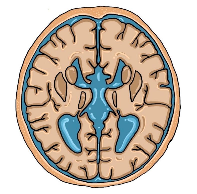 https://cdn.ncbi.nlm.nih.gov/pmc/blobs/5347/7565833/6802f98150b6/brainsci-10-00625-g002.jpg