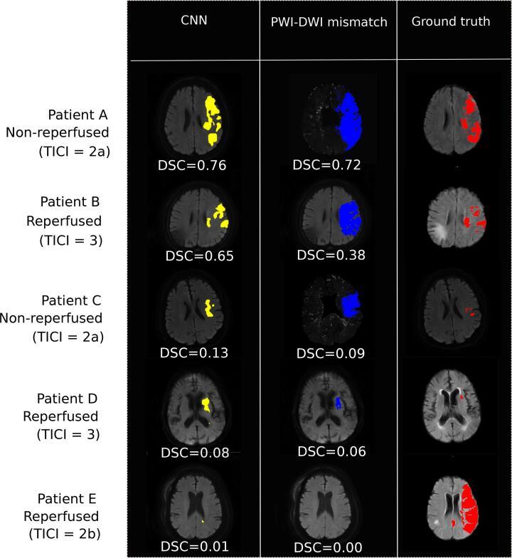 https://cdn.ncbi.nlm.nih.gov/pmc/blobs/534b/7810765/82ccecf809a4/gr4.jpg