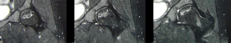 https://cdn.ncbi.nlm.nih.gov/pmc/blobs/5350/9022373/5c7332bda646/gr1_lrg.jpg