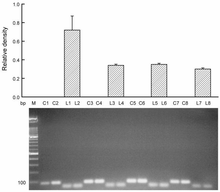 https://cdn.ncbi.nlm.nih.gov/pmc/blobs/5357/2886953/b3ccbd1e7783/nihms152138f3.jpg
