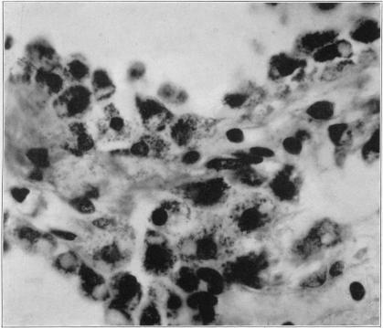https://cdn.ncbi.nlm.nih.gov/pmc/blobs/535c/2041787/564089d8efc6/jmedres00005-0060-a.jpg