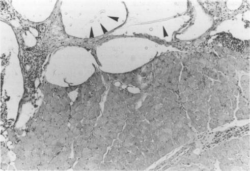 https://cdn.ncbi.nlm.nih.gov/pmc/blobs/535e/500799/65faff624090/jclinpath00268-0007-a.jpg