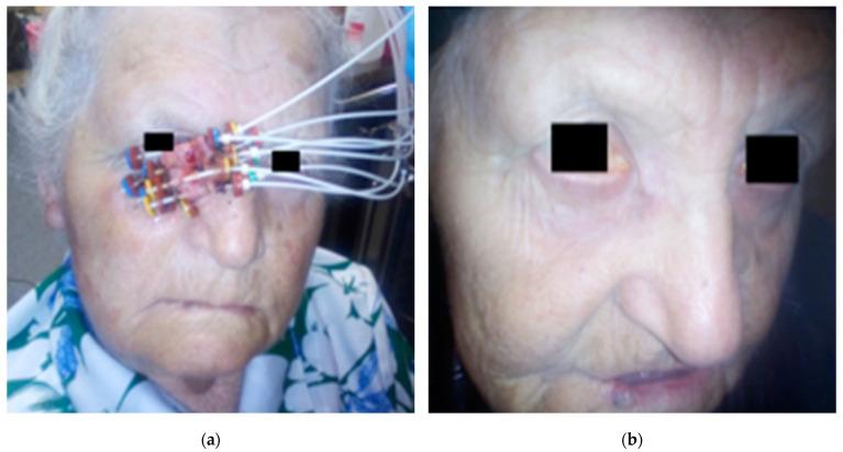https://cdn.ncbi.nlm.nih.gov/pmc/blobs/535e/8003955/739b57c8bb5e/cancers-13-01425-g001.jpg