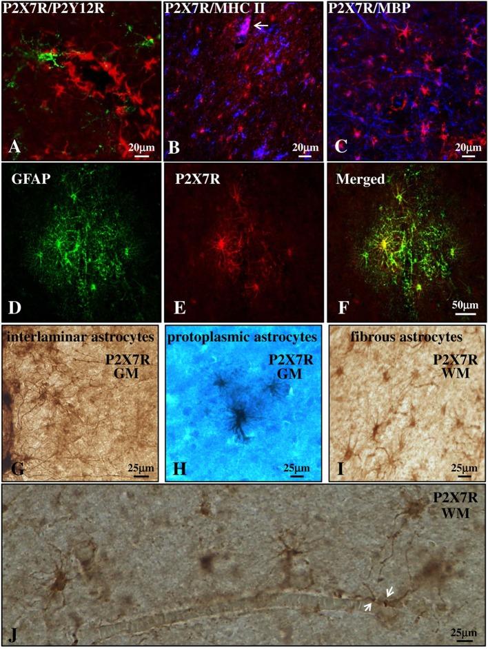 https://cdn.ncbi.nlm.nih.gov/pmc/blobs/5360/5694754/02adda5c7270/fimmu-08-01529-g003.jpg
