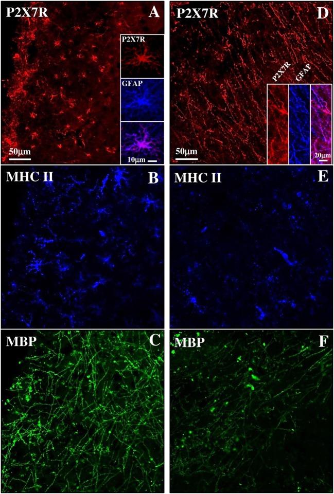 https://cdn.ncbi.nlm.nih.gov/pmc/blobs/5360/5694754/ffae24cb5c8a/fimmu-08-01529-g005.jpg