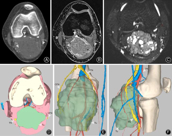 https://cdn.ncbi.nlm.nih.gov/pmc/blobs/5365/9627051/937625058e42/OS-14-3028-g003.jpg