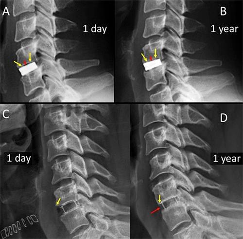 https://cdn.ncbi.nlm.nih.gov/pmc/blobs/5368/7206362/c171eb757921/or-12-1-8359-g004.jpg