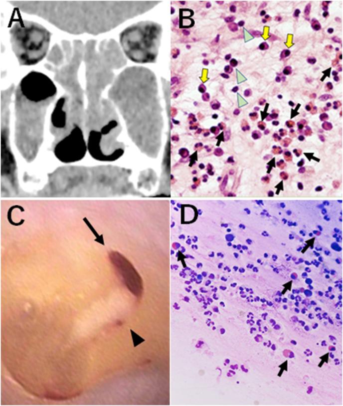 https://cdn.ncbi.nlm.nih.gov/pmc/blobs/536c/7809429/ddbcc4ae0feb/gr1.jpg