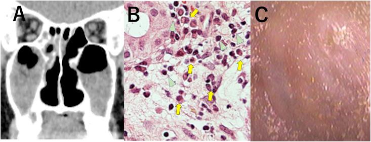 https://cdn.ncbi.nlm.nih.gov/pmc/blobs/536c/7809429/eed21b98e406/gr2.jpg