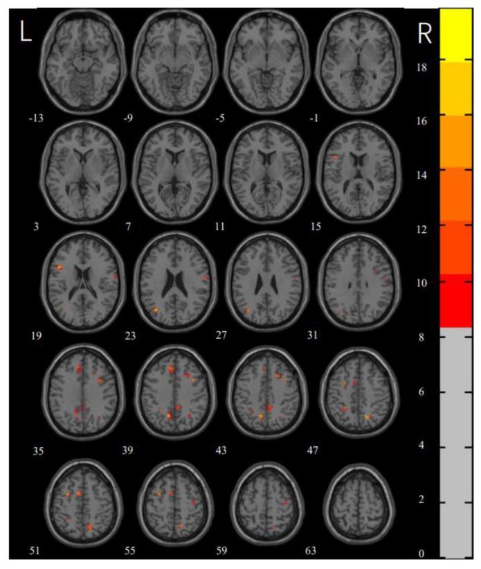 https://cdn.ncbi.nlm.nih.gov/pmc/blobs/536f/9406102/5a35bde8997b/brainsci-12-00998-g001.jpg