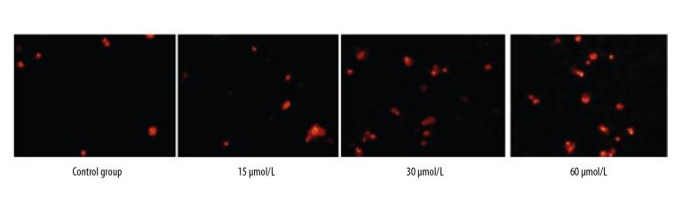 https://cdn.ncbi.nlm.nih.gov/pmc/blobs/5371/7251962/3559c1b6d0aa/medscimonit-26-e921606-g001.jpg