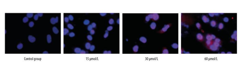 https://cdn.ncbi.nlm.nih.gov/pmc/blobs/5371/7251962/e674bd51c917/medscimonit-26-e921606-g006.jpg
