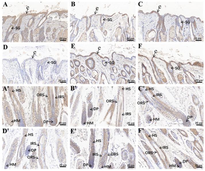 https://cdn.ncbi.nlm.nih.gov/pmc/blobs/537e/10855228/64aae40cf290/ijms-25-01594-g001.jpg