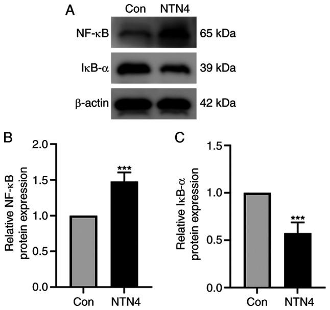 https://cdn.ncbi.nlm.nih.gov/pmc/blobs/5383/11273250/a15589d9d905/etm-28-03-12640-g03.jpg