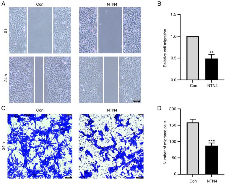 https://cdn.ncbi.nlm.nih.gov/pmc/blobs/5383/11273250/f4c7f08a4a4c/etm-28-03-12640-g01.jpg