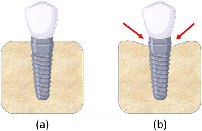 https://cdn.ncbi.nlm.nih.gov/pmc/blobs/5383/9968486/0bdb7e36cf9b/nihms-1875125-f0001.jpg