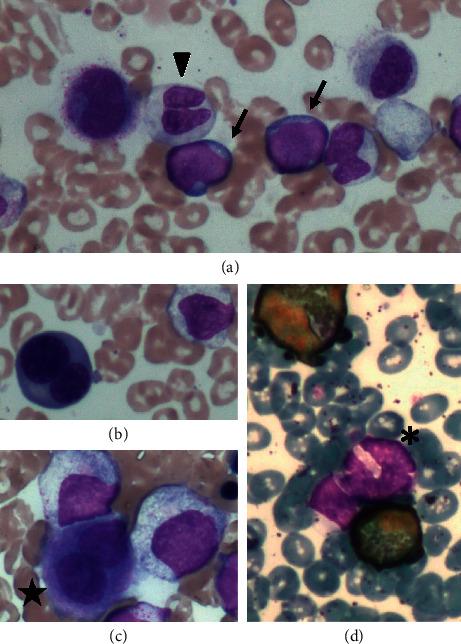 https://cdn.ncbi.nlm.nih.gov/pmc/blobs/5386/8084685/e2dc7b53ae11/CRIHEM2021-6640597.001.jpg