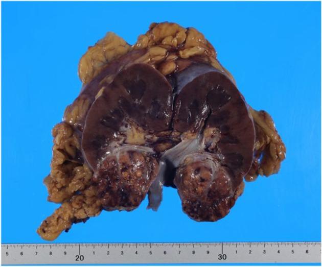 https://cdn.ncbi.nlm.nih.gov/pmc/blobs/538a/12055221/b8e494f390e8/IJU5-8-285-g001.jpg