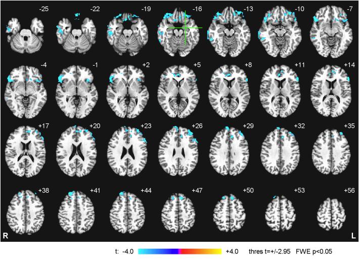 https://cdn.ncbi.nlm.nih.gov/pmc/blobs/538c/6051473/cbbf19bf0ae3/gr6.jpg