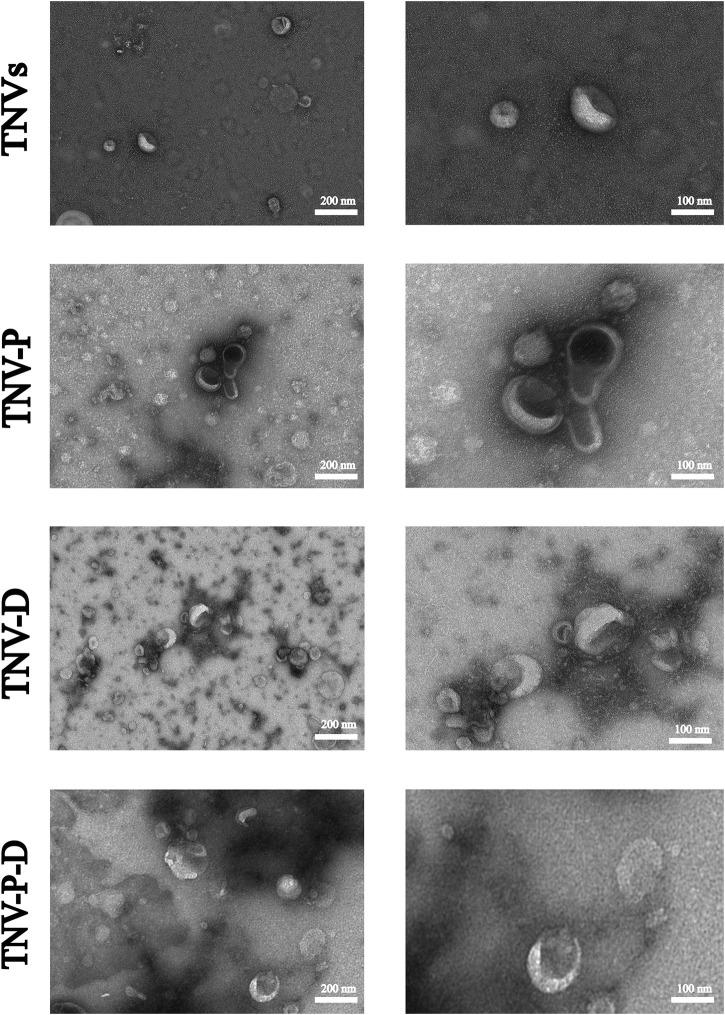 https://cdn.ncbi.nlm.nih.gov/pmc/blobs/538f/12162503/d95e693bb459/fphar-16-1587560-g001.jpg