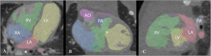 https://cdn.ncbi.nlm.nih.gov/pmc/blobs/5398/10481772/75f2b51043d3/ivad072f2.jpg