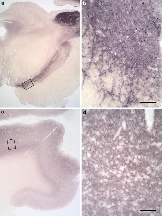 https://cdn.ncbi.nlm.nih.gov/pmc/blobs/5398/2892607/0cf163dc6461/401_2010_711_Fig3_HTML.jpg