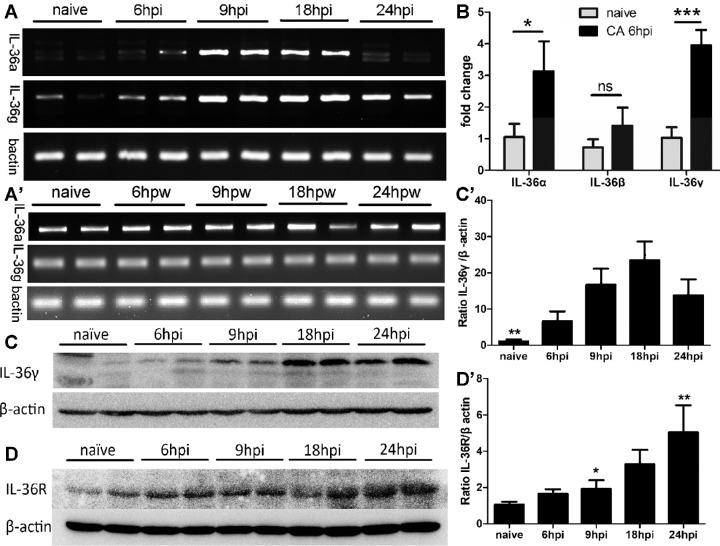https://cdn.ncbi.nlm.nih.gov/pmc/blobs/5399/8114008/81974d47711d/iovs-62-6-10-f001.jpg