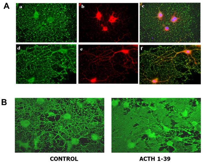 https://cdn.ncbi.nlm.nih.gov/pmc/blobs/539f/5575624/040b557ed420/brainsci-07-00104-g002.jpg