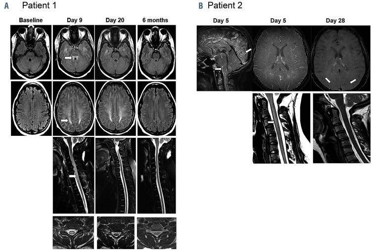 https://cdn.ncbi.nlm.nih.gov/pmc/blobs/53a0/8094092/f6016cbf5242/1061504.fig2.jpg