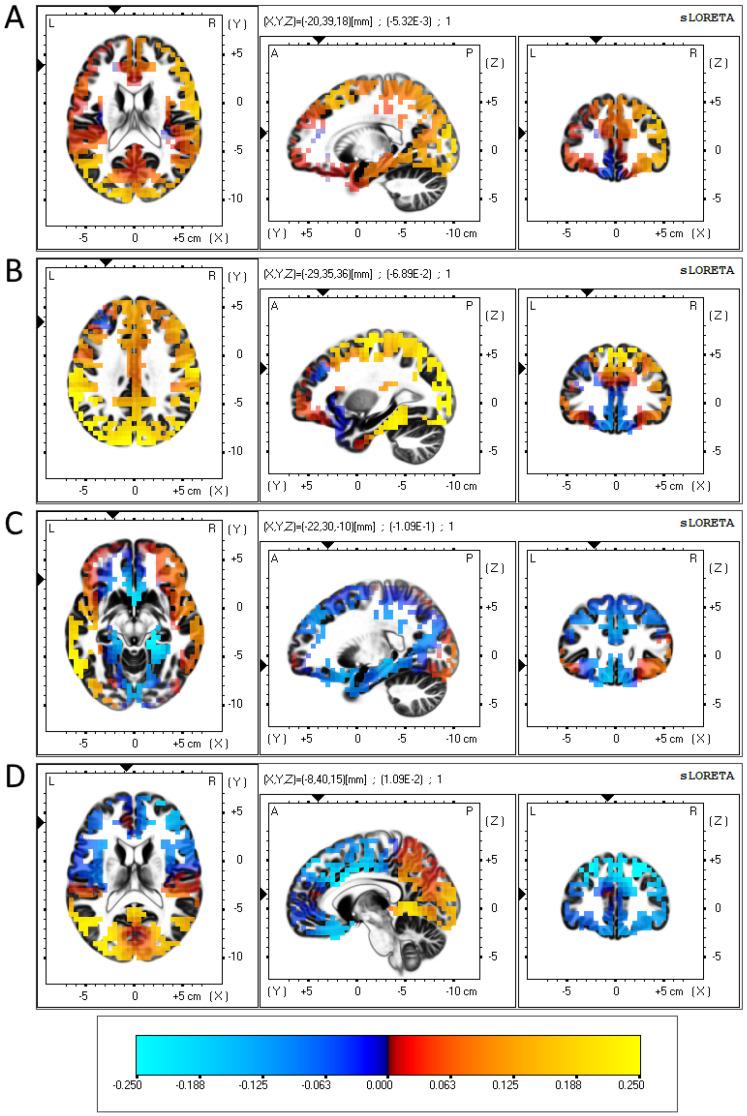 https://cdn.ncbi.nlm.nih.gov/pmc/blobs/53a7/10526132/39562b02c724/brainsci-13-01354-g001.jpg