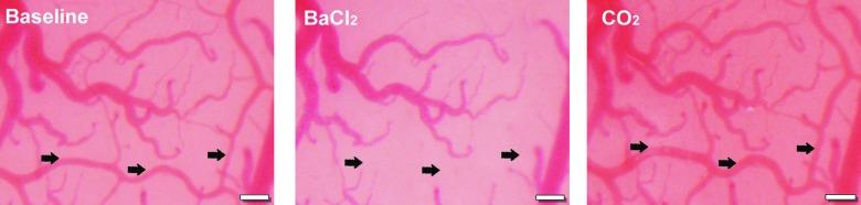 https://cdn.ncbi.nlm.nih.gov/pmc/blobs/53aa/6818492/46c8b1312efa/fig-1.jpg