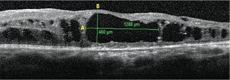 https://cdn.ncbi.nlm.nih.gov/pmc/blobs/53ad/6961082/f199b4cbafef/TJO-49-315-g1.jpg