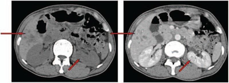 https://cdn.ncbi.nlm.nih.gov/pmc/blobs/53af/5008571/5a559ff5ce7b/medi-95-e4658-g002.jpg