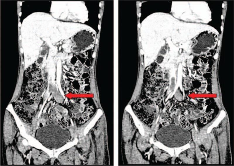 https://cdn.ncbi.nlm.nih.gov/pmc/blobs/53af/5008571/6b1236633dab/medi-95-e4658-g001.jpg