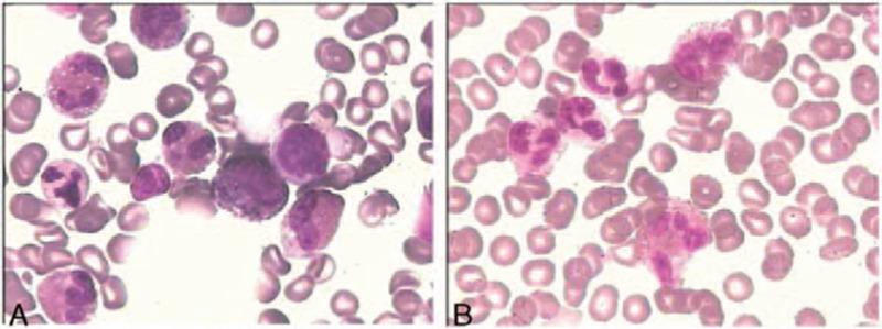 https://cdn.ncbi.nlm.nih.gov/pmc/blobs/53af/5008571/8d3e2c748d68/medi-95-e4658-g004.jpg