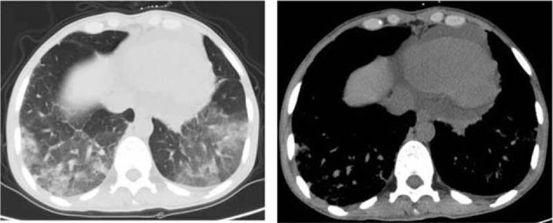 https://cdn.ncbi.nlm.nih.gov/pmc/blobs/53af/5008571/a7f3cee69396/medi-95-e4658-g003.jpg
