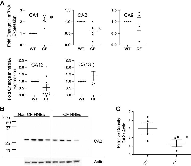 https://cdn.ncbi.nlm.nih.gov/pmc/blobs/53b1/8858677/2b25296b5a34/ajplung.00022.2021_f002.jpg