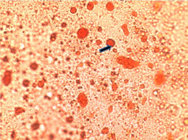 https://cdn.ncbi.nlm.nih.gov/pmc/blobs/53bc/3280944/0e8ddbf9163a/1476-511X-10-216-4.jpg