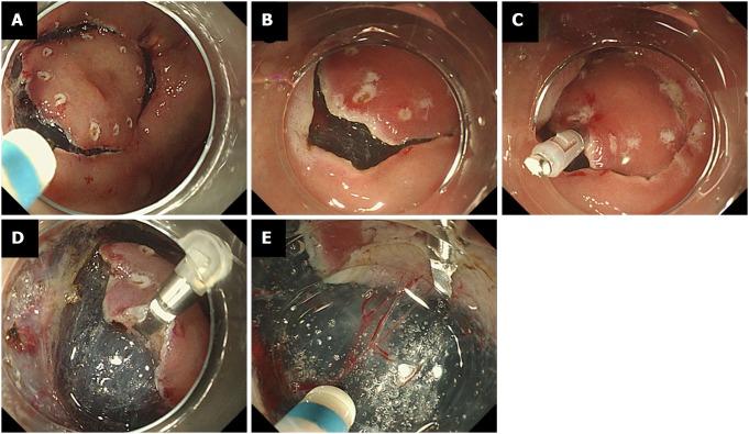 https://cdn.ncbi.nlm.nih.gov/pmc/blobs/53bc/6148425/42bc4dc8437d/WJG-24-4077-g002.jpg