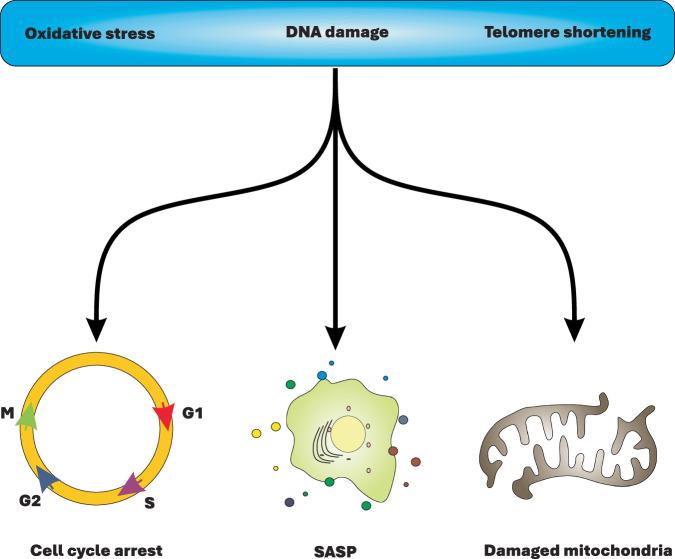 https://cdn.ncbi.nlm.nih.gov/pmc/blobs/53c0/12322153/e18345ab4fc5/41420_2025_2655_Fig1_HTML.jpg