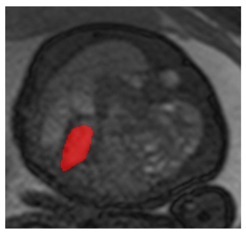 https://cdn.ncbi.nlm.nih.gov/pmc/blobs/53ca/10779621/312bebe1e4b8/jcm-13-00268-g002.jpg