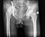 https://cdn.ncbi.nlm.nih.gov/pmc/blobs/53cc/10276239/2eb3255af343/CCR3-11-e7569-g002.jpg